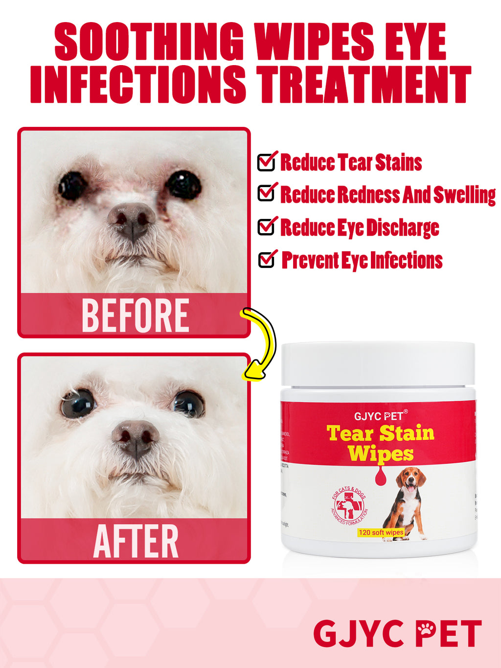 Tear Stain Remover Eye Wipes